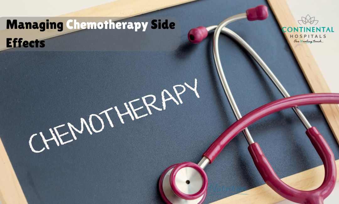 Managing Chemotherapy Side Effects